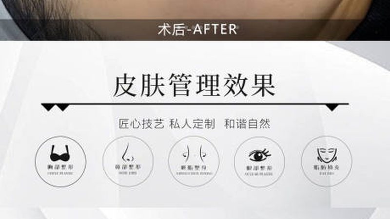 双眼皮手术：价格与效果背后的真相揭秘