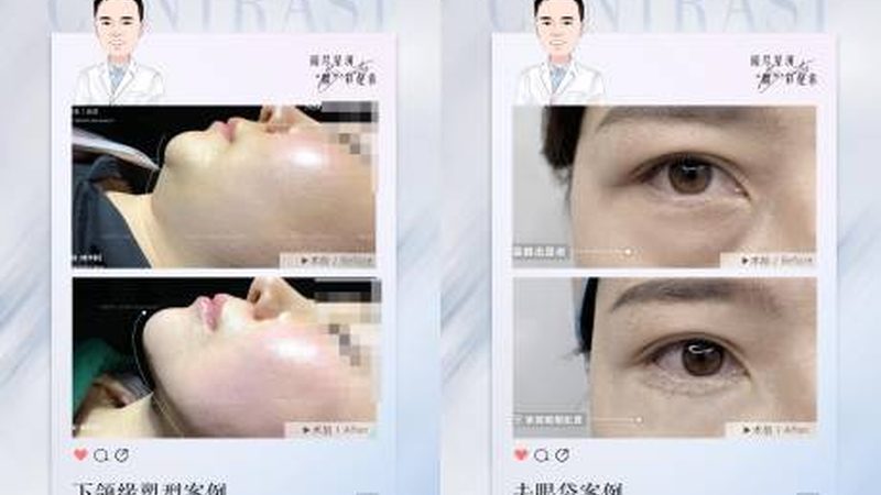热玛吉与线雕：探寻医美抗衰的两种方式