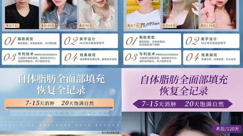 公立医院埋线提升：揭秘手术原理与选择标准