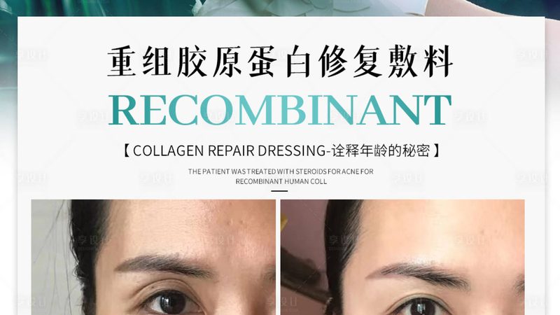 家用光子嫩肤仪，你真的会用吗？**