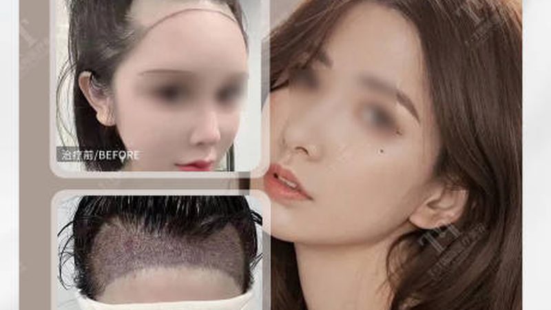 美容注射针剂操作流程揭秘：安全与效果的保障之道