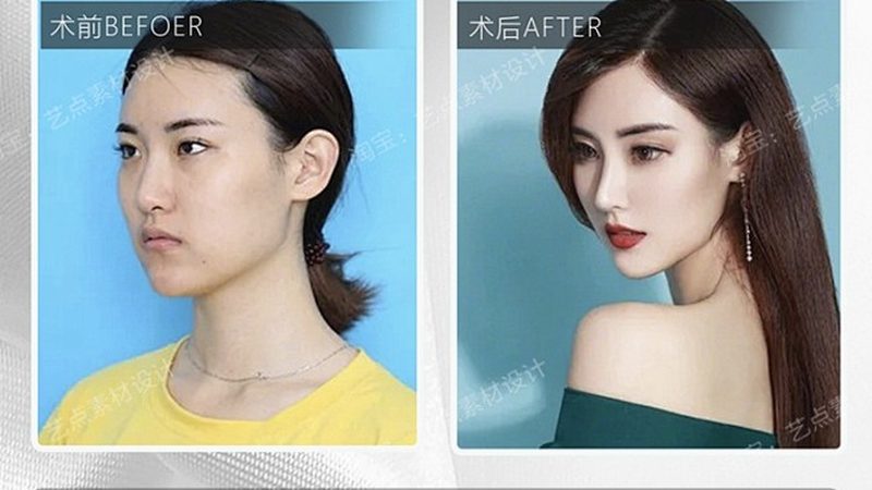 贴双眼皮贴眼皮松弛能修复吗