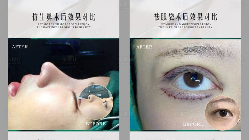 初普抗衰美容仪：揭秘其价格背后的技术秘密