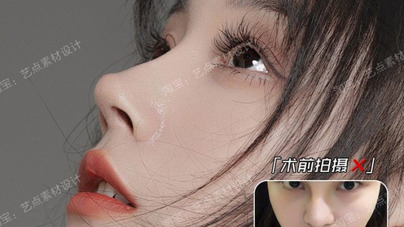肉毒素注射间隔时间医生建议