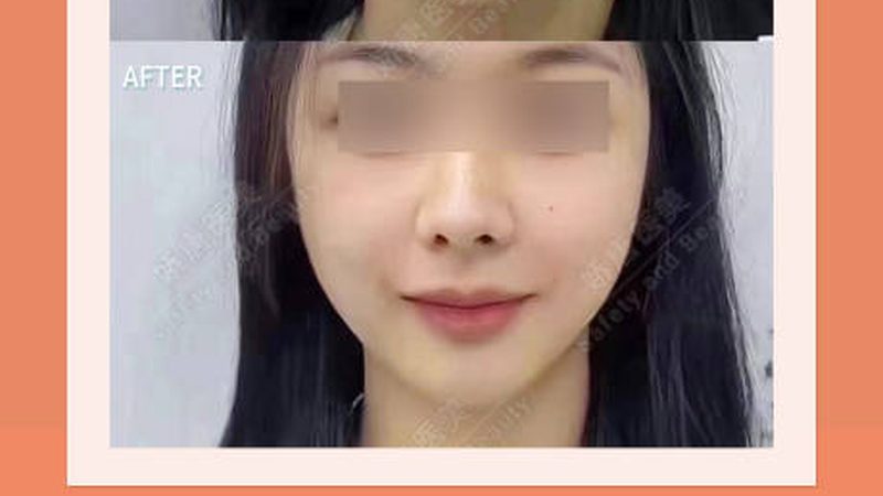 如何甄别北京正规医美机构：安全与效果的保障