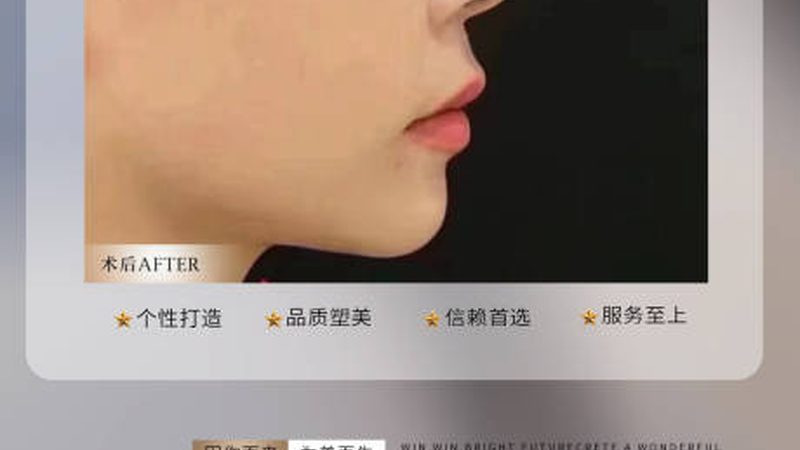 隆鼻后戴眼镜，鼻梁会压歪吗？揭秘术后护理细节**
