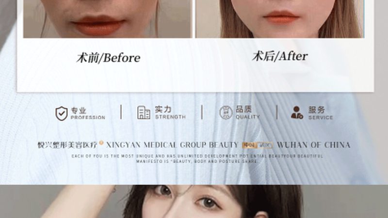 揭秘注射美容品牌正规资质的识别方法