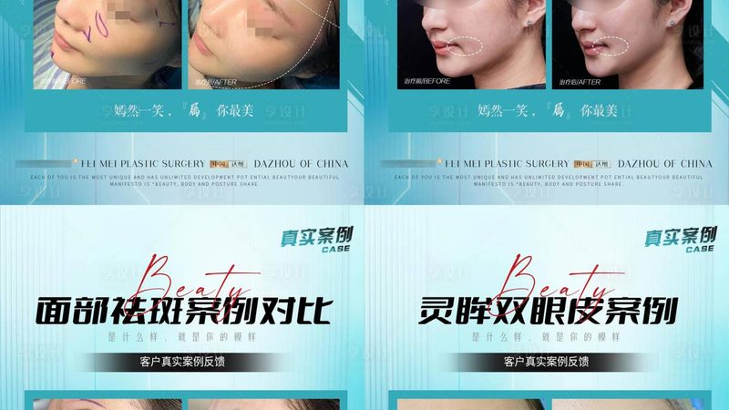 美容仪超声炮：揭秘其原理与选购要点