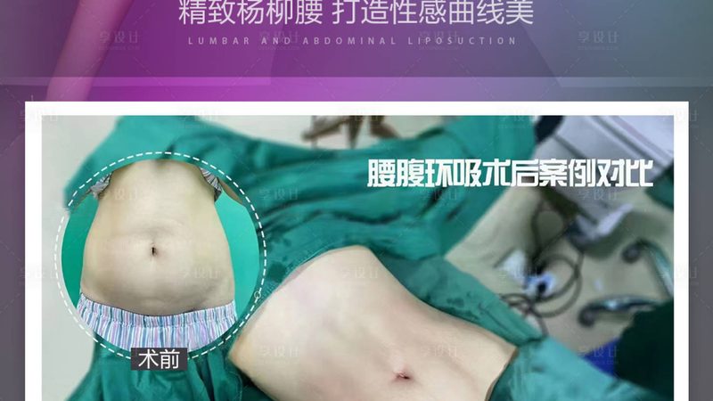 轻医美仪器：揭秘价格背后的技术秘密