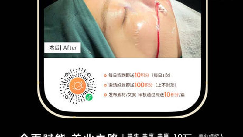 医美咨询师必备：案例学习全攻略