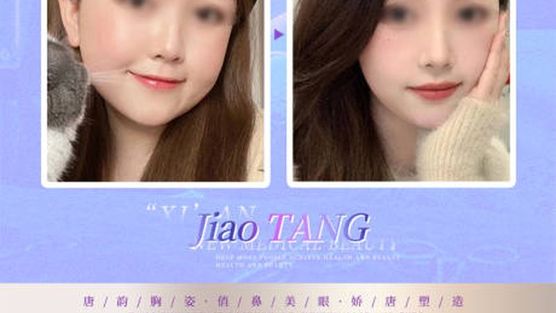 三甲医院光子嫩肤去红血丝，揭秘收费标准背后的秘密