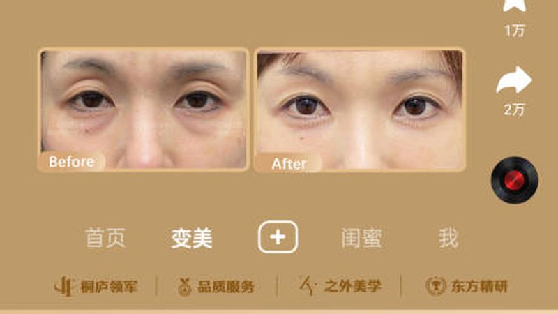 注射美容术后，哪些食物要忌口？**
