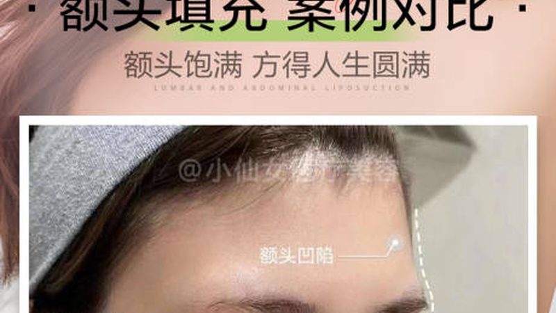 超声炮术后运动，这些注意事项要知道